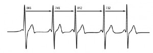 HRV